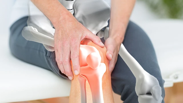 Phương Thuốc Chữa Bệnh Xương Khớp - Gout ảnh 1